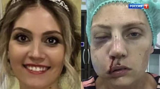 Бывший муж российской модели избил ее на глазах сына в Таиланде - «Новости шоубизнеса»