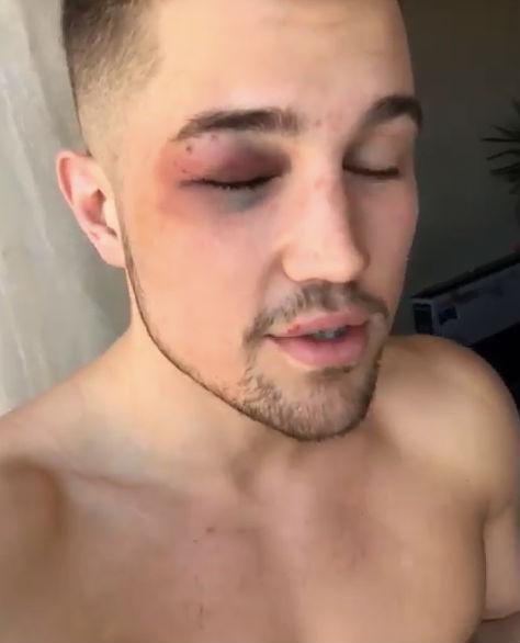 «Это, наверное, страсть»: звезду «Дома-2» Романа Гриценко избила новая возлюбленная - «Новости шоубизнеса»