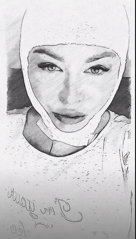 «Я перевязанная вся»: Дарья Пынзарь напугала поклонников первым фото после пластической операции - «Новости шоубизнеса»