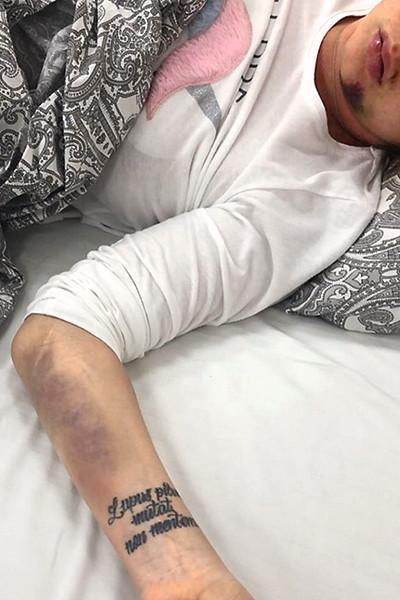 После аварии в палату к МакSим пригласили священника - «Новости шоубизнеса»