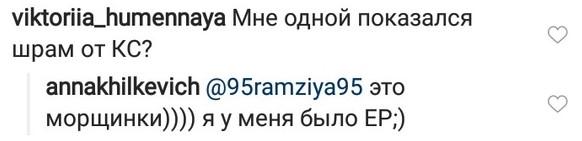 Анна Хилькевич опровергла слухи о кесаревом сечении - «Новости шоубизнеса»
